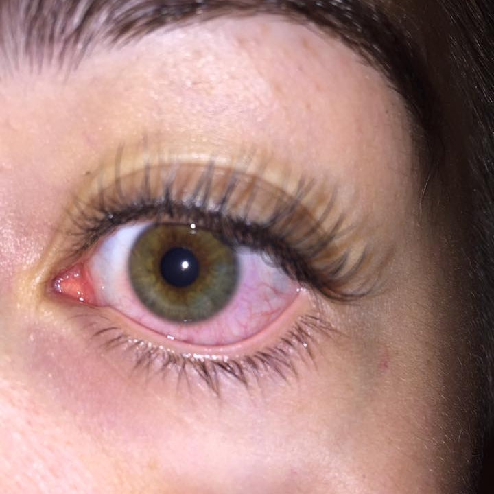 What to Ask: Eyelash Extension Allergies and Reactions — Lash Affair